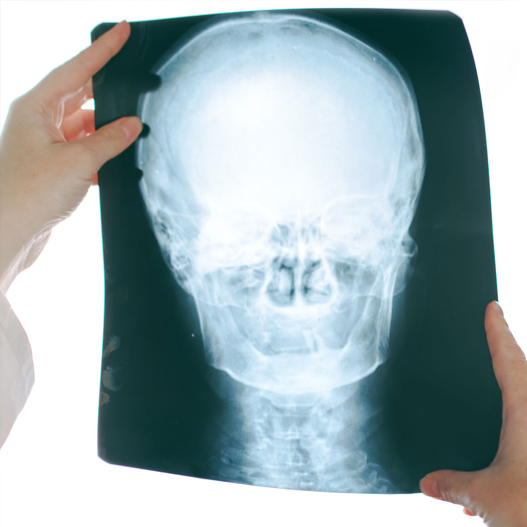 Imagen de un profesional de la salud evaluando una radiografía de la cabeza del paciente